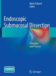 Endoscopic Submucosal Dissection