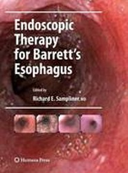 Endoscopic Therapy for Barrett's Esophagus