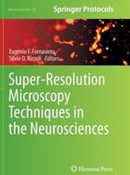 Super-Resolution Microscopy Techniques in the Neurosciences