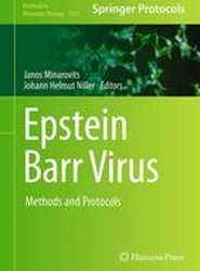 Epstein Barr Virus