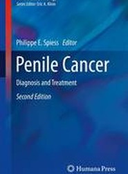 Penile Cancer