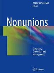 Nonunions