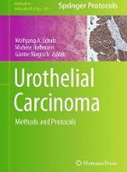 Urothelial Carcinoma