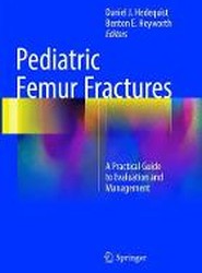 Pediatric Femur Fractures