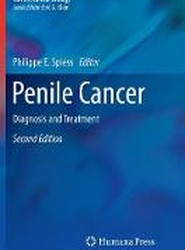 Penile Cancer