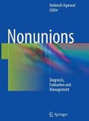 Nonunions