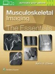 Musculoskeletal Imaging: The Essentials