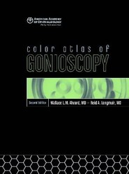 Color Atlas of Gonioscopy