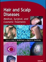 Hair and Scalp Diseases