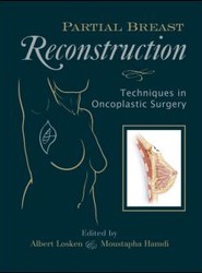 Partial Breast Reconstruction