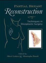 Partial Breast Reconstruction