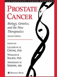 Prostate Cancer