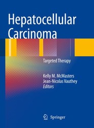 Hepatocellular Carcinoma: