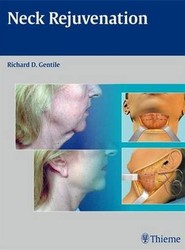 Neck Rejuvenation