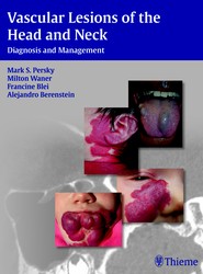 Vascular Lesions of the Head and Neck