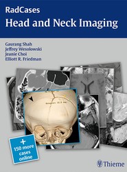 RadCases Head and Neck Imaging