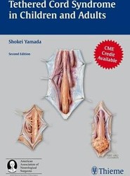 Tethered Cord Syndrome in Children and Adults