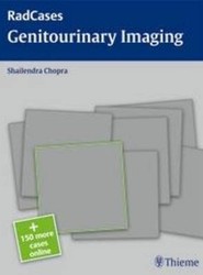 Radcases Genitourinary Imaging