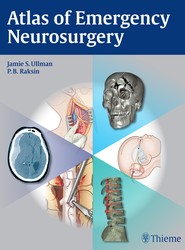 Atlas of Emergency Neurosurgery
