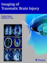 Imaging of Traumatic Brain Injury
