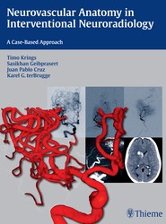 Neurovascular Anatomy in Interventional Neuroradiology