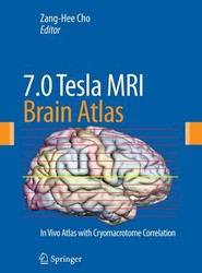 7.0 TeslaMRI Brain Atlas