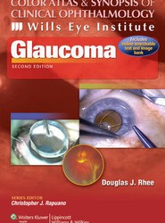 Color Atlas and Synopsis of Clinical Ophthalmology -- Wills Eye Institute -- Glaucoma