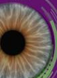 CME (Cystoid Macular Edema)