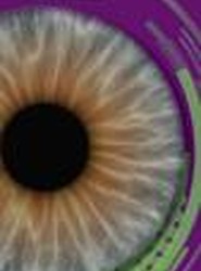 Laser Trabeculoplasty