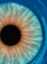 Posterior Capsulotomy