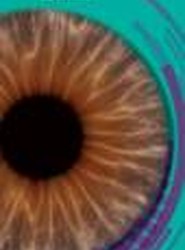 Retinopatia Diabetica