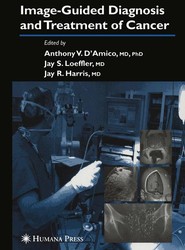 Image-Guided Diagnosis and Treatment of Cancer