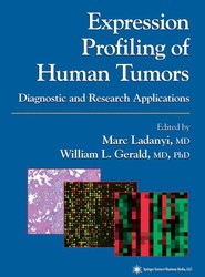 Expression Profiling of Human Tumors