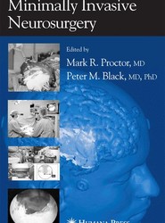 Minimally Invasive Neurosurgery