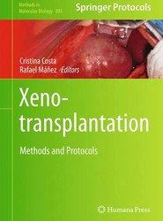 Xenotransplantation