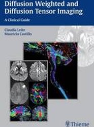 Diffusion Weighted and Diffusion Tensor Imaging