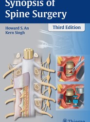 Synopsis of Spine Surgery