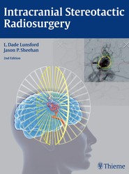 Intracranial Stereotactic Radiosurgery
