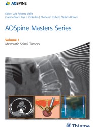 AOSpine Masters Series Volume 1: Metastatic Spinal Tumors