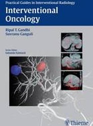Interventional Oncology