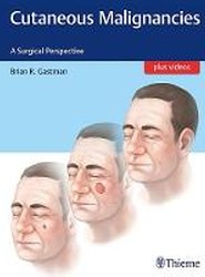 Cutaneous Malignancies