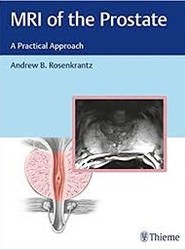 MRI of the Prostate