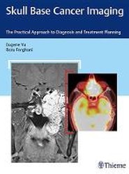 Skull Base Cancer Imaging
