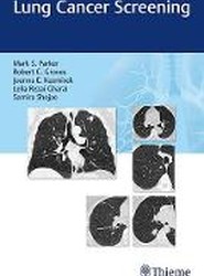 Lung Cancer Screening