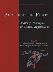 Perforator Flaps