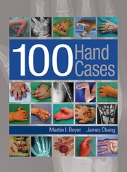 100 Hand Cases