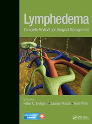 Lymphedema