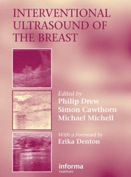 Interventional Ultrasound of the Breast