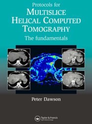 Protocols for Multislice Helical Computed Tomography