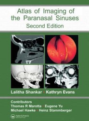 Atlas of Imaging of the Paranasal Sinuses, Second Edition